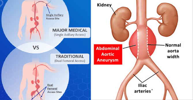 Major_Medical-Blog